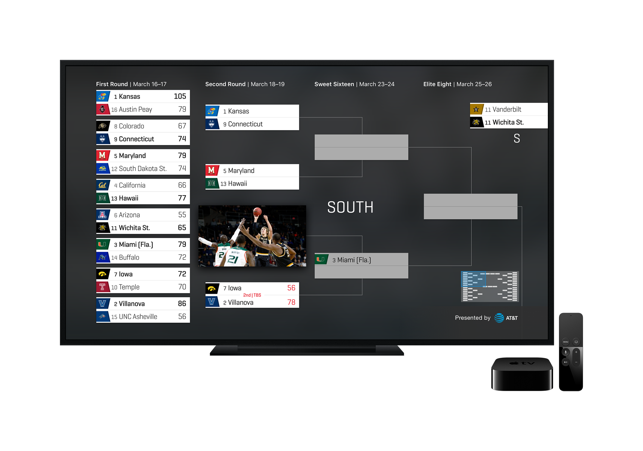 Bracket CTV